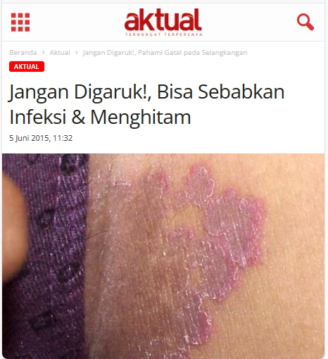 AKTUAL-BERITA-SLENGKY.webp